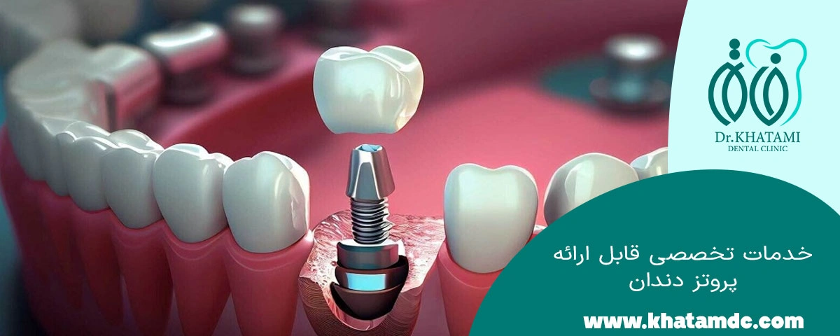 خدمات قابل ارائه